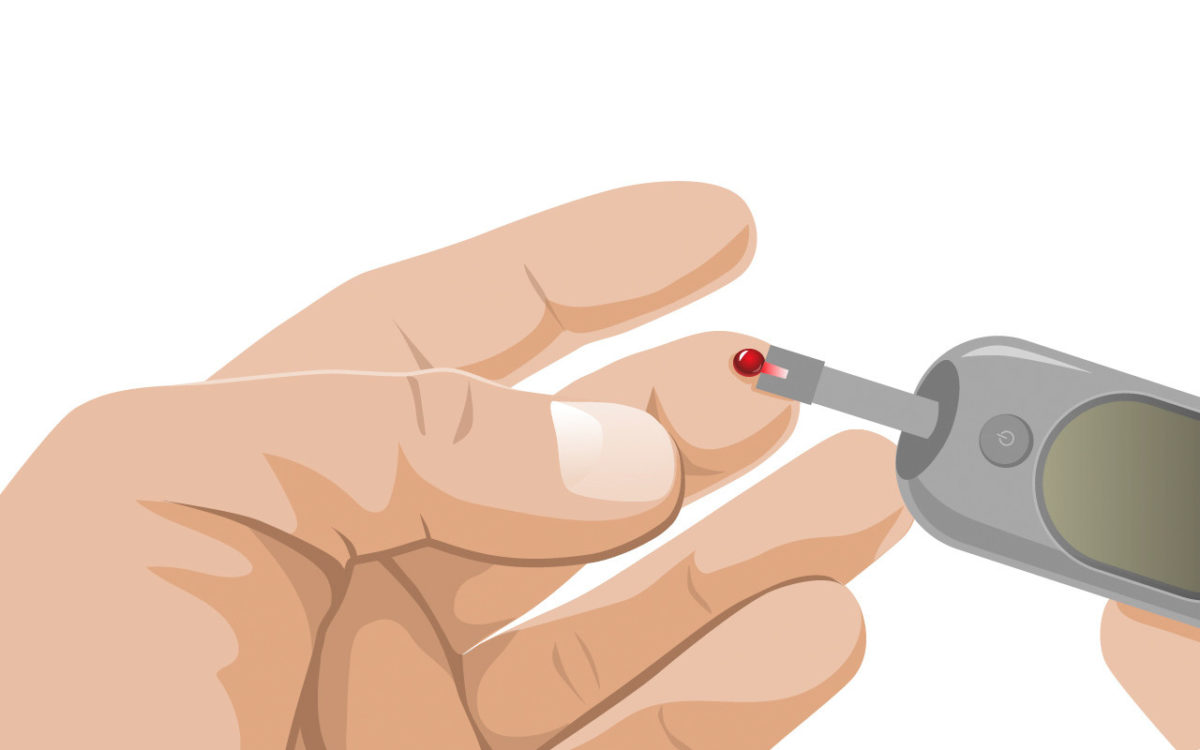 Allgemeinerkrankungen (z.B. Diabetes Mellitus Typ II)