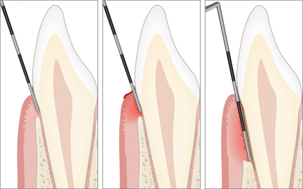 Klinische Untersuchung